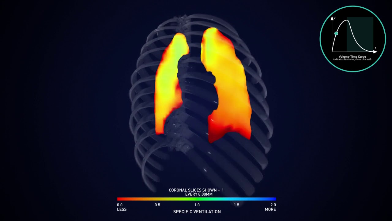 4DMedical-led Joint Venture Granted $28.9M Medical Funding For New Lung ...