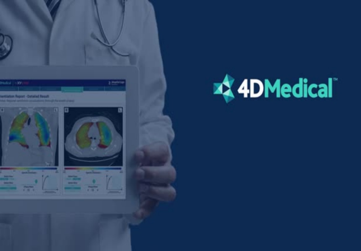 University Of Chicago Medicine Adopts 4DMedicals Advanced Imaging Tech